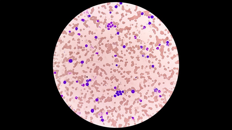 Mutational Profile Can Help Guide Waldenström Treatment