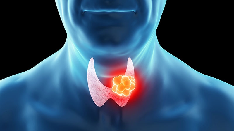 Updates on Risk, Diagnosis, and Treatment of Thyroid Cancer